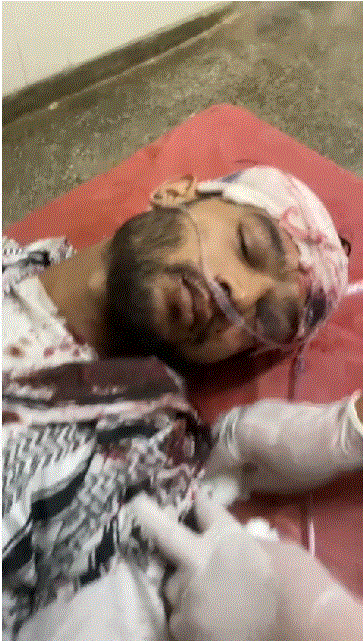 हादसे में घायल युवको की मदद को आगे आए स्थानीय युवा।