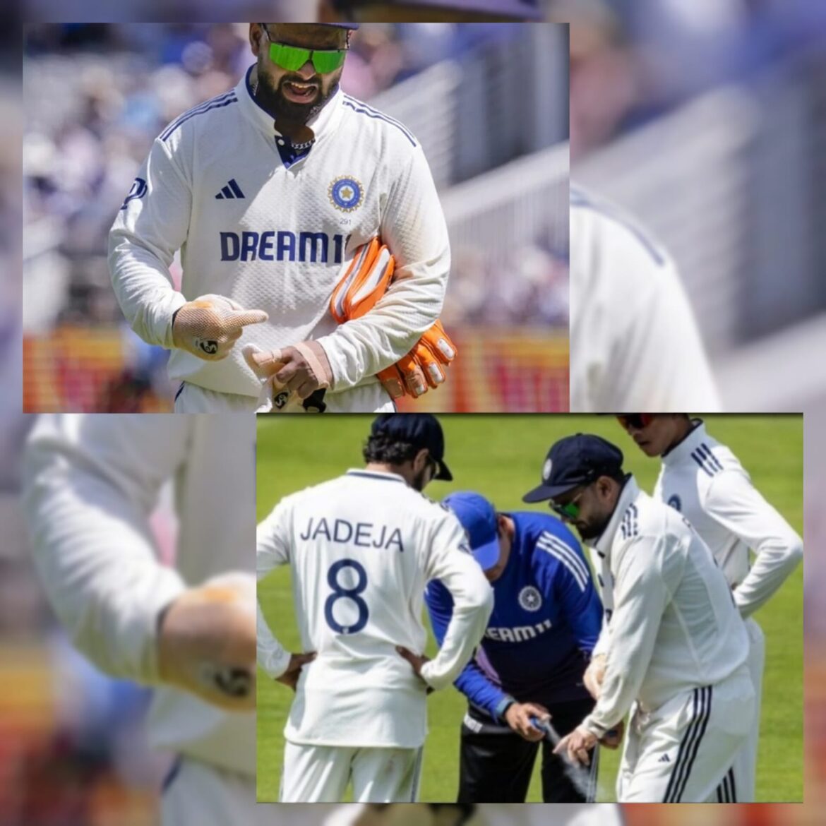 IND vs ENG: ऋषभ पंत की चोट पर BCCI का अपडेट – क्या खेल पाएंगे लॉर्ड्स टेस्ट में आगे?