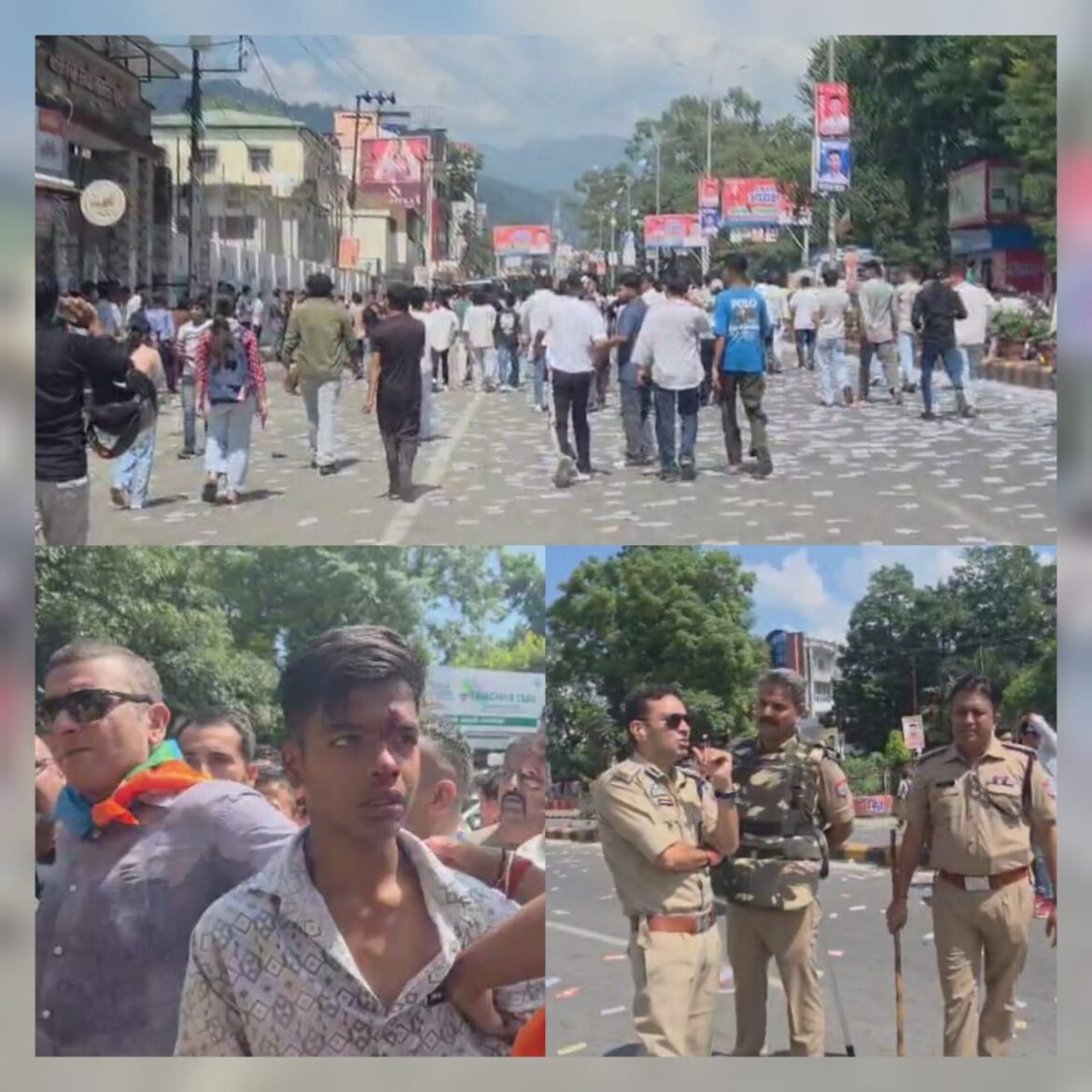 एमबीपीजी कॉलेज छात्र संघ चुनाव: घायल युवक ने बढ़ाई माहौल की नाजुकता