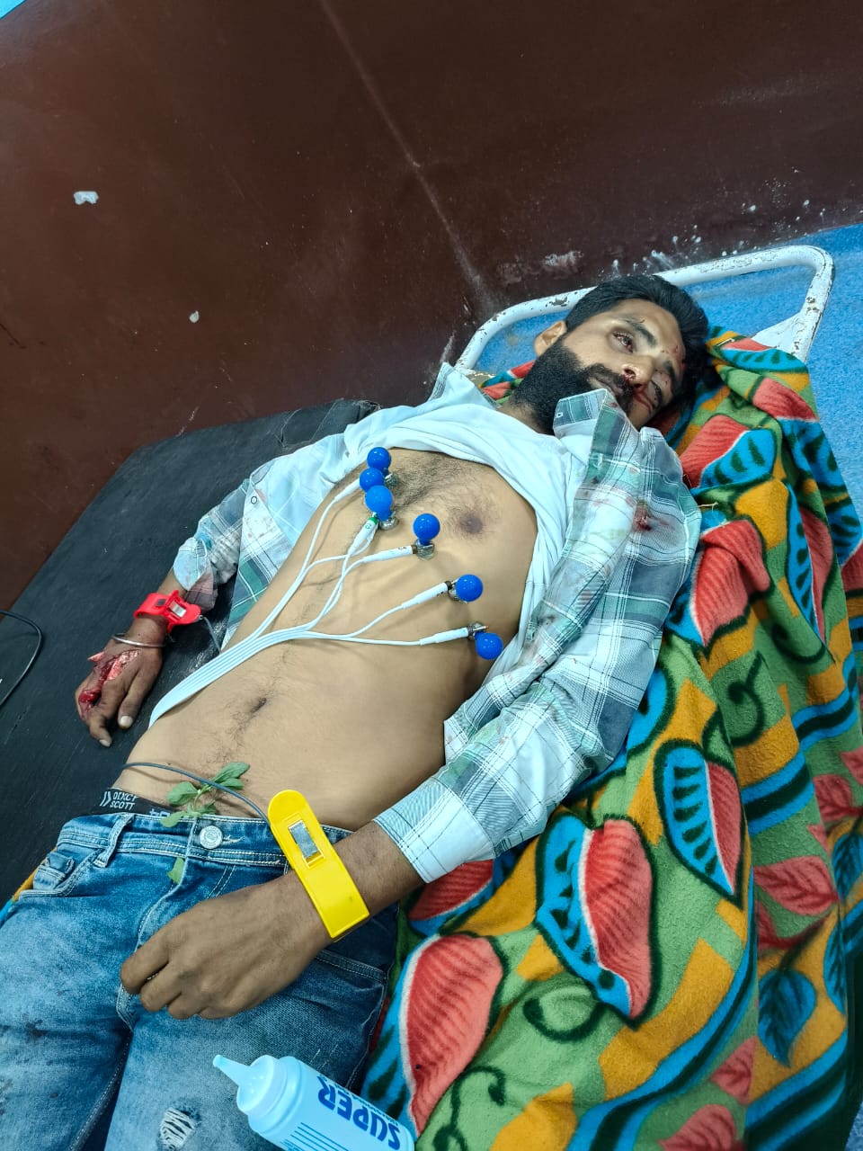 अज्ञात वाहन की टक्कर से बाइक सवार की मौत, पुलिस ने शुरू की जांच