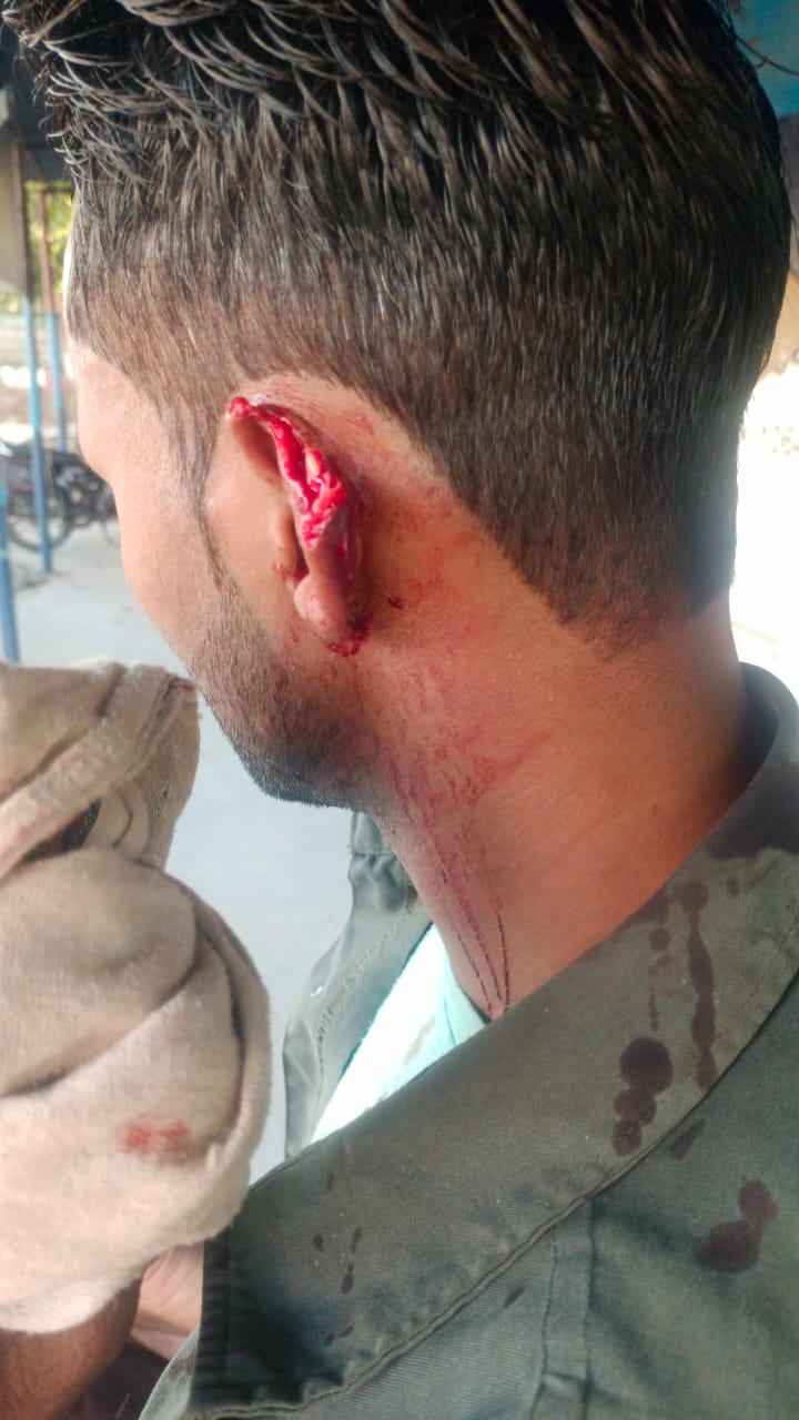 हरिद्वार में गैस सिलेंडर कर्मचारियों पर जानलेवा हमला, एक की हालत गंभीर