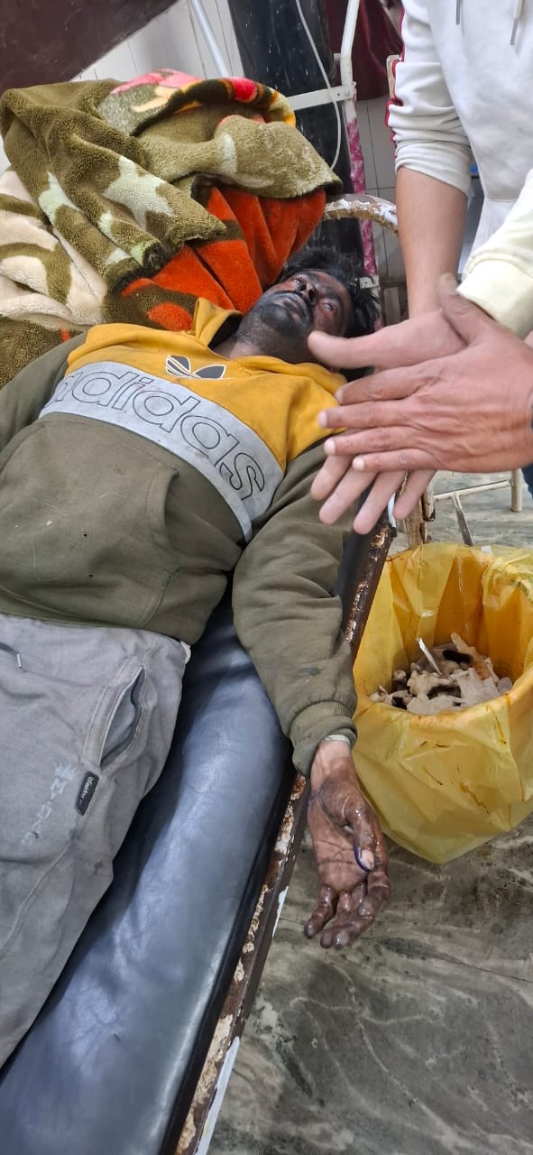 जसपुर महुआडाबरा में टेंट हाउस के गोदाम में भीषण आग, एक घायल