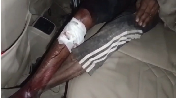 पतरामपुर में गुलदार का हमला, युवक गंभीर रूप से घायल—ग्रामीणों में बढ़ा डर