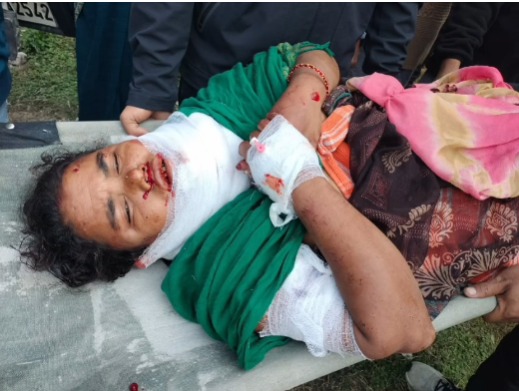 पौड़ी में गुलदार का आतंक जारी, घास काटने गई महिला पर हमला; क्षेत्र में दहशत