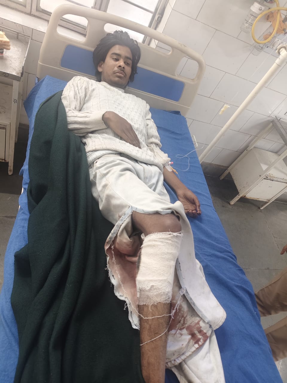 खटीमा हत्याकांड में मुख्य आरोपी हाशिम का एनकाउंटर, पैर में लगी गोली