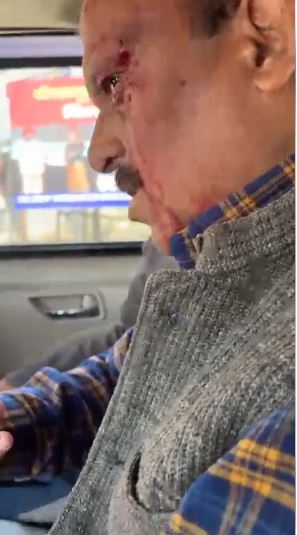 शिक्षा निदेशक से मारपीट प्रकरण पर सियासत तेज, विपक्ष ने की कड़ी कार्रवाई की मांग