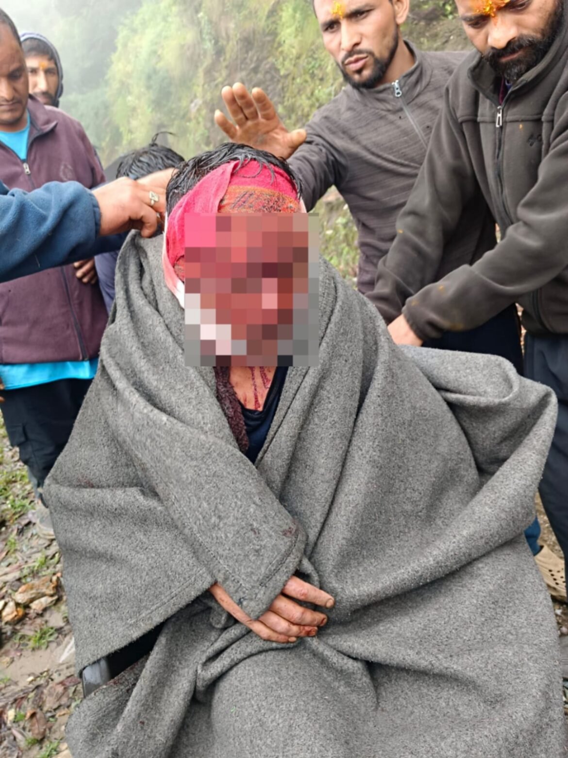 कलगोठ गांव में भालू का हमला, ग्रामीणों में दहशत एक व्यक्ति गंभीर रूप से घायल, वन विभाग से गश्त बढ़ाने और सुरक्षा के ठोस इंतजाम की मांग